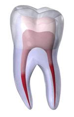 alameda area tooth root canal cheap